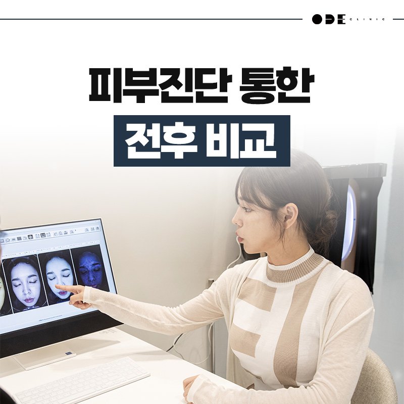 시술 후기
